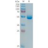 sp-PME101365 PRL Fig.1 SDS PAGE 1