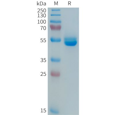 sp-PME101365 PRL Fig.1 SDS PAGE 1