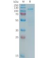 sp-PME101366 LRP5 Fig.1 SDS PAGE 1