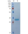 sp-PME101367 BCMA Fig.1 SDS PAGE 1