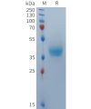 sp-PME101370 BCMA Fig.1 SDS PAGE 1