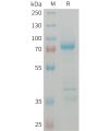 sp-PME101372 GDF8 Fig.1 SDS PAGE 1