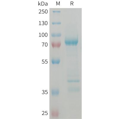 sp-PME101372 GDF8 Fig.1 SDS PAGE 1