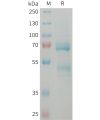 sp-PME101373 CCN2 Fig.1 SDS PAGE 1