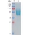 sp-PME101375 CGRPR Fig.1 SDS PAGE 1