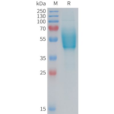 sp-PME101375 CGRPR Fig.1 SDS PAGE 1