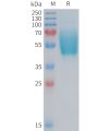 sp-PME101376 CGRPR Fig.1 SDS PAGE 1