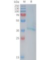 sp-PME101377 RAMP1 Fig.1 SDS PAGE 1