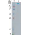 sp-PME101378 ITGB6 Fig.1 SDS PAGE 1