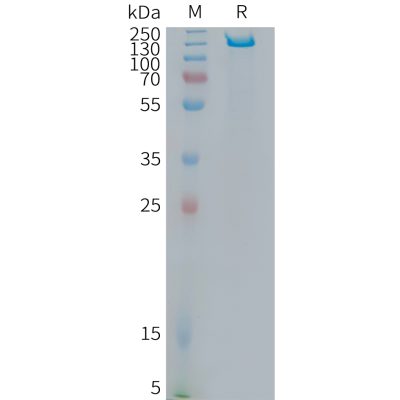 sp-PME101378 ITGB6 Fig.1 SDS PAGE 1