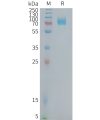 sp-PME101379 CD22 Fig.1 SDS PAGE 1