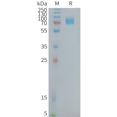 sp-PME101379 CD22 Fig.1 SDS PAGE 1