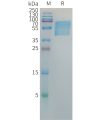 sp-PME101381 HBSAG Fig.1 SDS PAGE 1