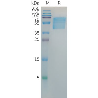 sp-PME101381 HBSAG Fig.1 SDS PAGE 1