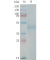 sp-PME101384 CDH17 Fig.1 SDS PAGE 1