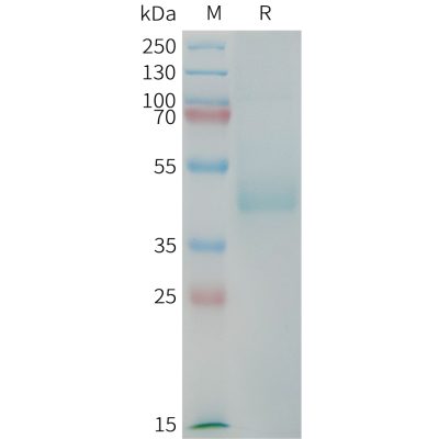 sp-PME101384 CDH17 Fig.1 SDS PAGE 1