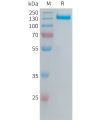 sp-PME101386 ITGAVITGB6 Fig.1 SDS PAGE 1