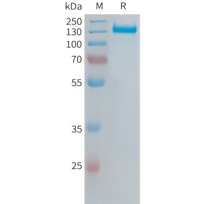 sp-PME101386 ITGAVITGB6 Fig.1 SDS PAGE 1