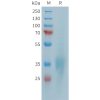 sp-PME101387 CD28 Fig.1 SDS PAGE 1
