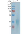 sp-PME101387 CD28 Fig.1 SDS PAGE 1