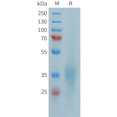 sp-PME101387 CD28 Fig.1 SDS PAGE 1