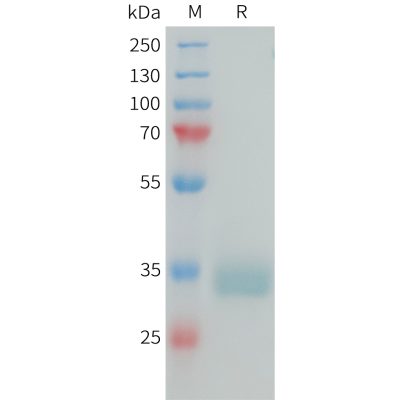 sp-PME101388 PRLR Fig.1 SDS PAGE 1