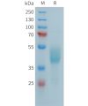 sp-PME101390 FCRL5 Fig.1 SDS PAGE 1