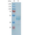 sp-PME101391 FCRL5 Fig.1 SDS PAGE 1