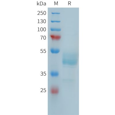 sp-PME101391 FCRL5 Fig.1 SDS PAGE 1