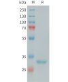 sp-PME101392 FCN1 Fig.1 SDS PAGE 1