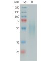 sp-PME101393 DR6 Fig.1 SDS PAGE 1