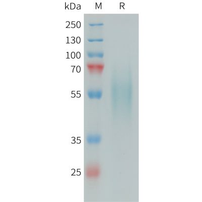 sp-PME101393 DR6 Fig.1 SDS PAGE 1