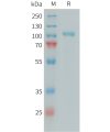 sp-PME101394 C1S Fig.1 SDS PAGE 1