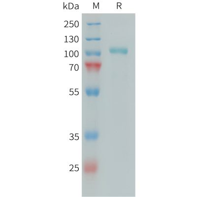 sp-PME101394 C1S Fig.1 SDS PAGE 1