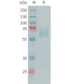 sp-PME101395 PSAP Fig.1 SDS PAGE 1