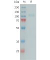 sp-PME101396 CFI Fig.1 SDS PAGE 1