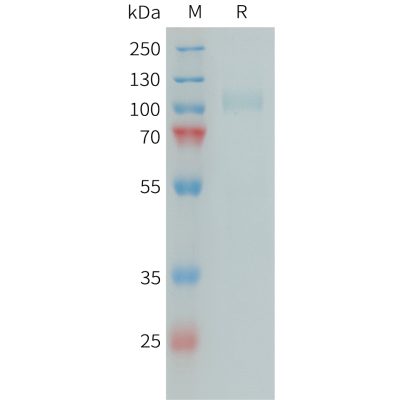 sp-PME101396 CFI Fig.1 SDS PAGE 1