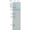 sp-PME101398 PLA2R1 Fig.1 SDS PAGE 1