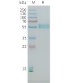 sp-PME101398 PLA2R1 Fig.1 SDS PAGE 1