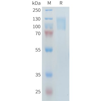 sp-PME101399 PLA2R1 Fig.1 SDS PAGE 1