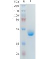 sp-PME101400 PLA2R1 Fig.1 SDS PAGE 1