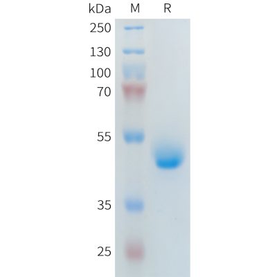 sp-PME101400 PLA2R1 Fig.1 SDS PAGE 1