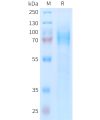 sp-PME101401 ADGRE5 Fig.1 SDS PAGE 1