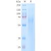 sp-PME101402 TIM4 Fig.1 SDS PAGE 1