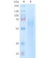 sp-PME101402 TIM4 Fig.1 SDS PAGE 1