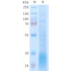 sp-PME101403 GLP2R Fig.1 SDS PAGE 1