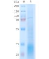 sp-PME101403 GLP2R Fig.1 SDS PAGE 1