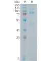 sp-PME101405 MET Fig.1 SDS PAGE 1