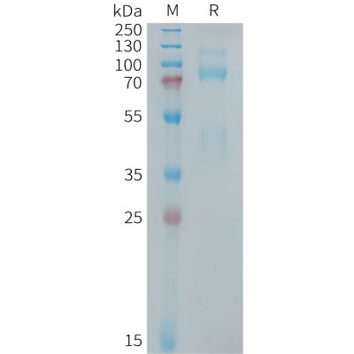 sp-PME101405 MET Fig.1 SDS PAGE 1