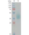 sp-PME101407 KLK1 Fig.1 SDS PAGE 1